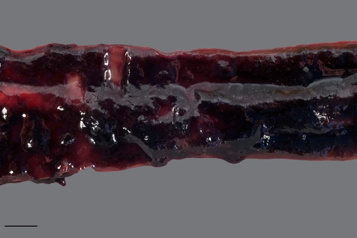 HỘI CHỨNG TIÊU CHẢY XUẤT HUYẾT CẤP TÍNH Ở CHÓ (ACUTE HEMORRHAGIC DIARRHEA SYNDROME - AHDS)